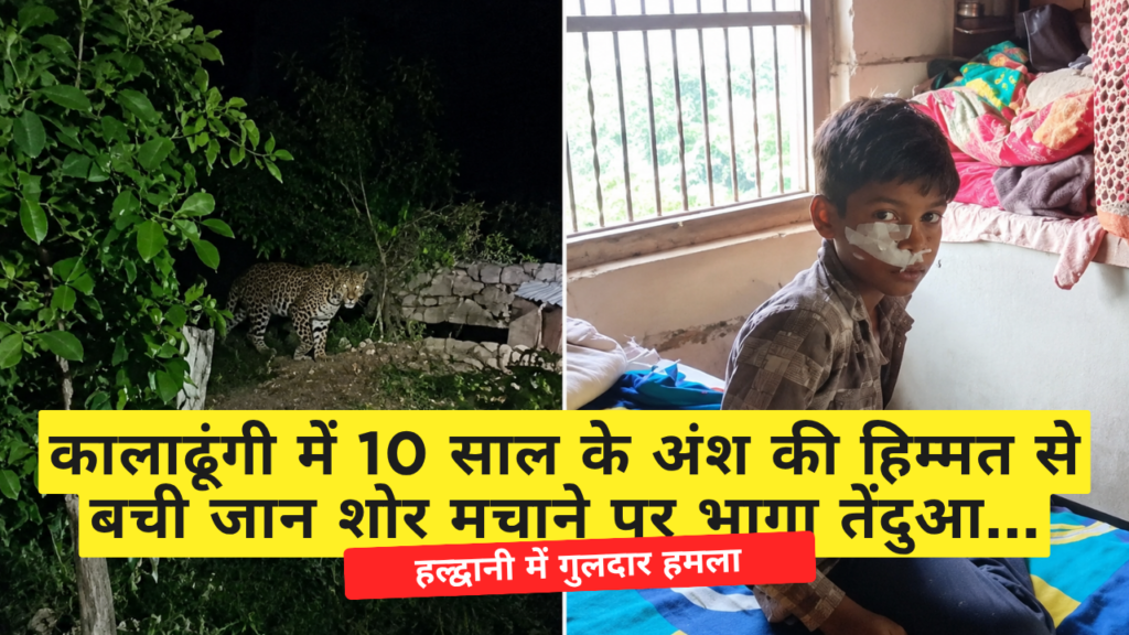 हल्द्वानी में गुलदार हमला